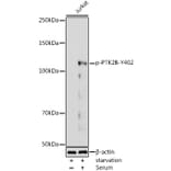 Western Blot - Anti-PYK2 (phospho Tyr402) Antibody (A16518) - Antibodies.com