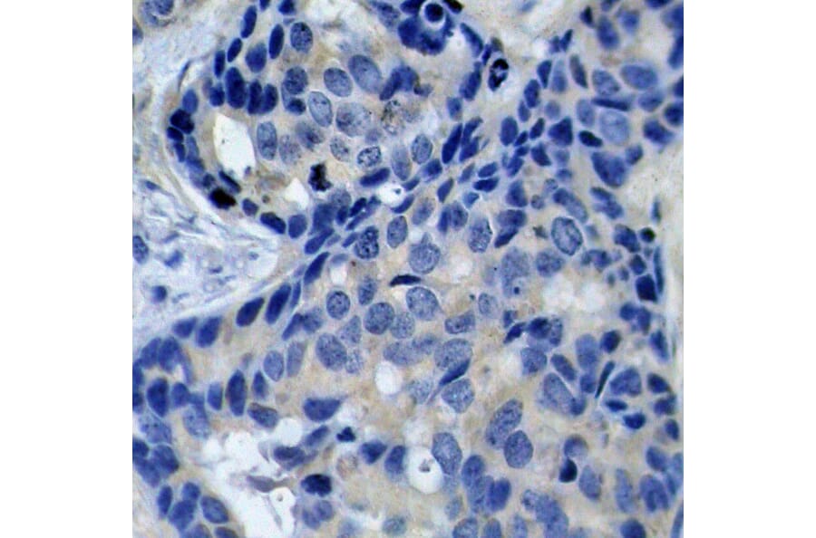 Immunohistochemistry - Anti-PYK2 (phospho Tyr402) Antibody (A16518) - Antibodies.com