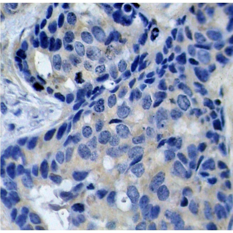 Immunohistochemistry - Anti-PYK2 (phospho Tyr402) Antibody (A16518) - Antibodies.com