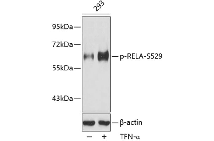 Western Blot - Anti-RELA (phospho S529) Antibody (AP0215) - Antibodies.com