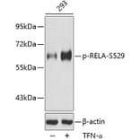 Western Blot - Anti-RELA (phospho S529) Antibody (AP0215) - Antibodies.com