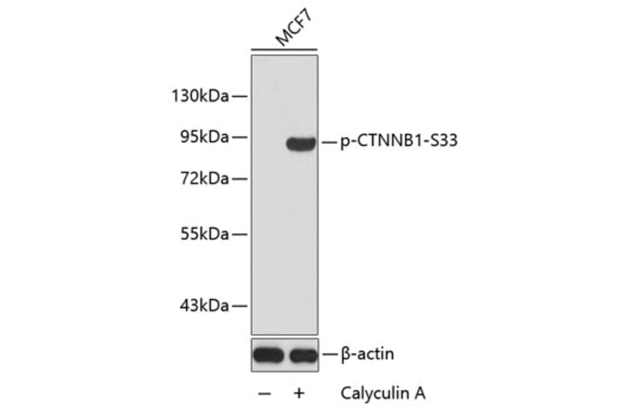 Western Blot - Anti-CTNNB1 (phospho S33) Antibody (AP0216) - Antibodies.com