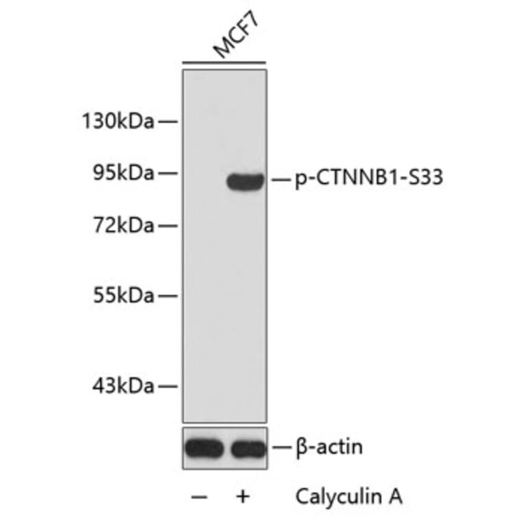 Western Blot - Anti-CTNNB1 (phospho S33) Antibody (AP0216) - Antibodies.com