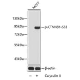 Western Blot - Anti-CTNNB1 (phospho S33) Antibody (AP0216) - Antibodies.com