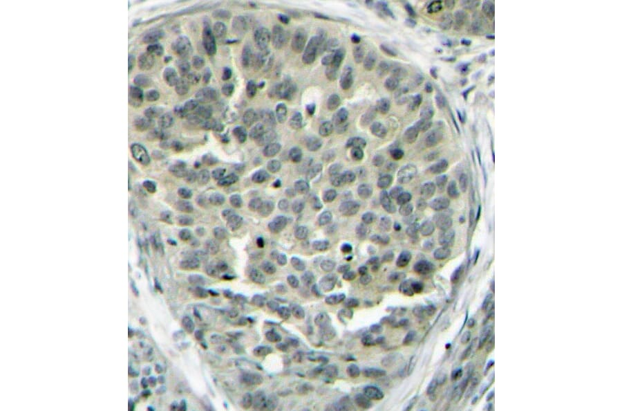 Immunohistochemistry - Anti-CTNNB1 (phospho S37) Antibody (AP0217) - Antibodies.com