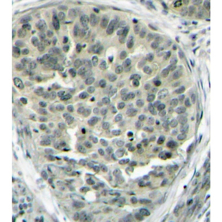 Immunohistochemistry - Anti-CTNNB1 (phospho S37) Antibody (AP0217) - Antibodies.com