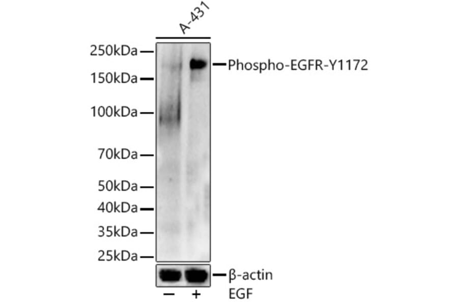 Western Blot - Anti-EGFR (phospho Tyr1172) Antibody (A16522) - Antibodies.com