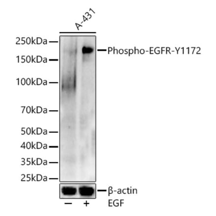 Western Blot - Anti-EGFR (phospho Tyr1172) Antibody (A16522) - Antibodies.com