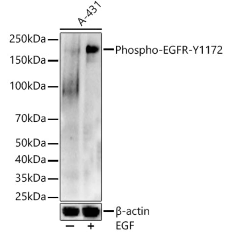 Western Blot - Anti-EGFR (phospho Tyr1172) Antibody (A16522) - Antibodies.com