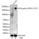 Western Blot - Anti-EGFR (phospho Tyr1172) Antibody (A16522) - Antibodies.com
