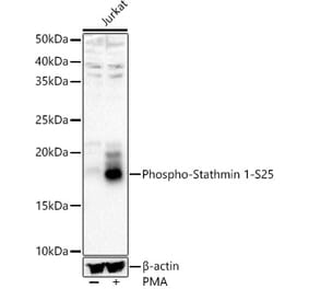 Western Blot - Anti-Stathmin 1 (phospho Ser25) Antibody (A16523) - Antibodies.com