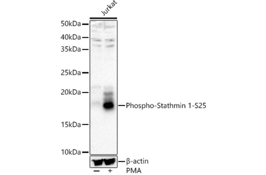 Western Blot - Anti-Stathmin 1 (phospho Ser25) Antibody (A16523) - Antibodies.com