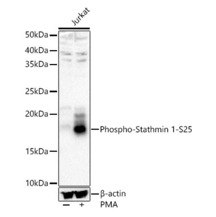Western Blot - Anti-Stathmin 1 (phospho Ser25) Antibody (A16523) - Antibodies.com