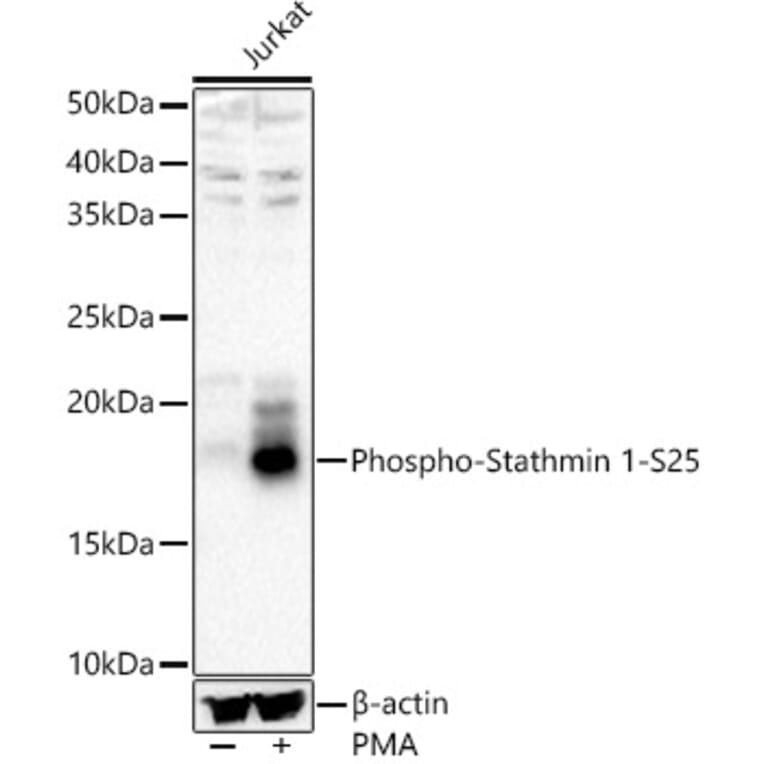 Western Blot - Anti-Stathmin 1 (phospho Ser25) Antibody (A16523) - Antibodies.com