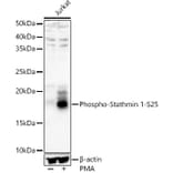 Western Blot - Anti-Stathmin 1 (phospho Ser25) Antibody (A16523) - Antibodies.com