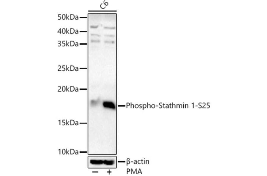 Western Blot - Anti-Stathmin 1 (phospho Ser25) Antibody (A16523) - Antibodies.com