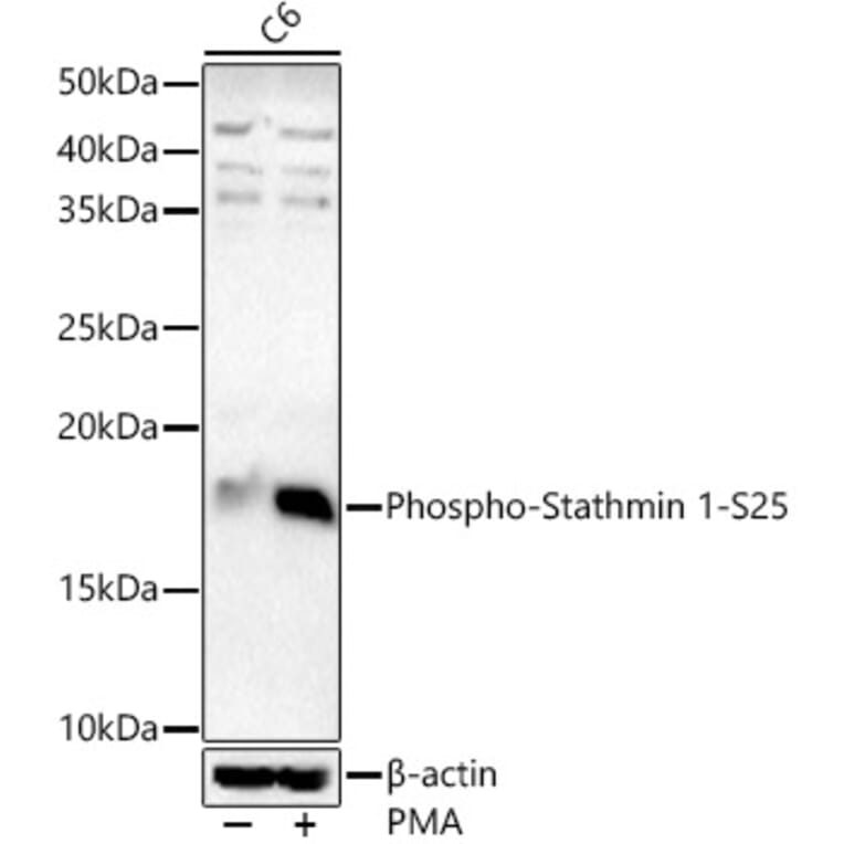 Western Blot - Anti-Stathmin 1 (phospho Ser25) Antibody (A16523) - Antibodies.com