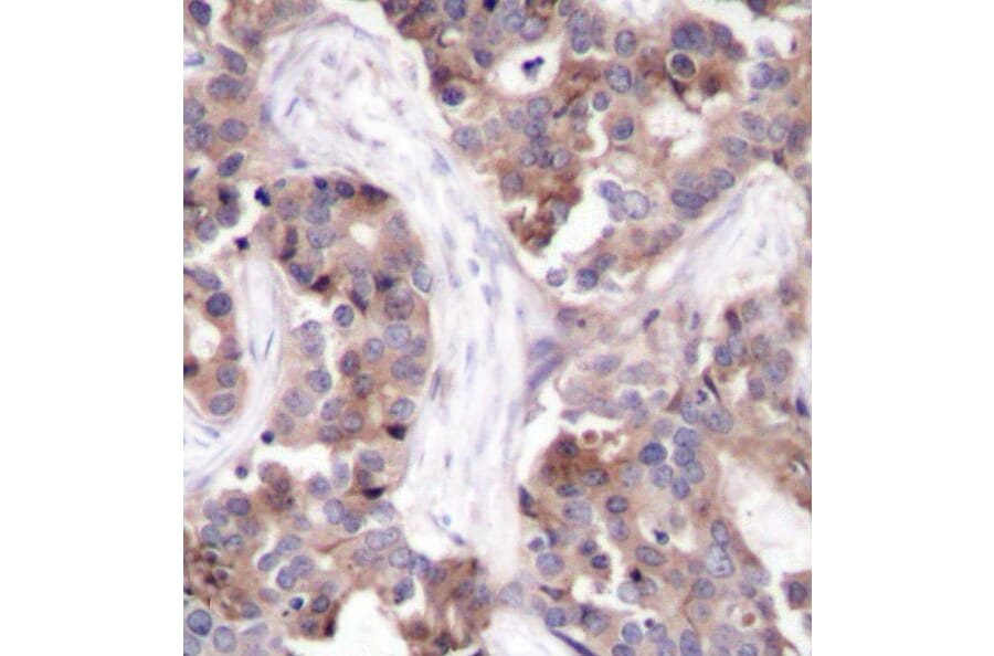 Immunohistochemistry - Anti-Stathmin 1 (phospho Ser25) Antibody (A16523) - Antibodies.com