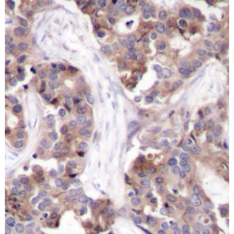 Immunohistochemistry - Anti-Stathmin 1 (phospho Ser25) Antibody (A16523) - Antibodies.com