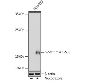 Western Blot - Anti-Stathmin 1 (phospho Ser38) Antibody (A16524) - Antibodies.com