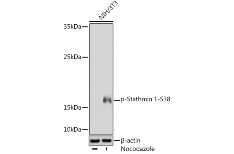 Western Blot - Anti-Stathmin 1 (phospho Ser38) Antibody (A16524) - Antibodies.com
