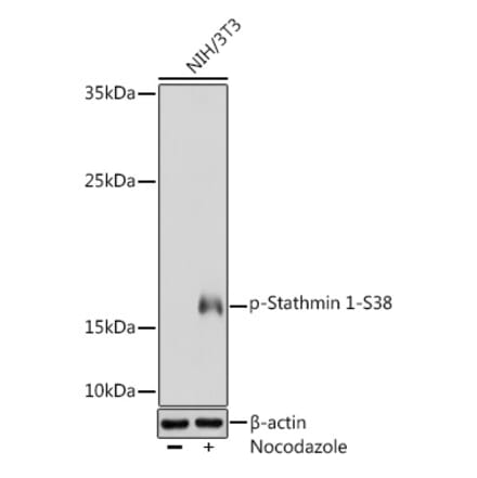 Western Blot - Anti-Stathmin 1 (phospho Ser38) Antibody (A16524) - Antibodies.com