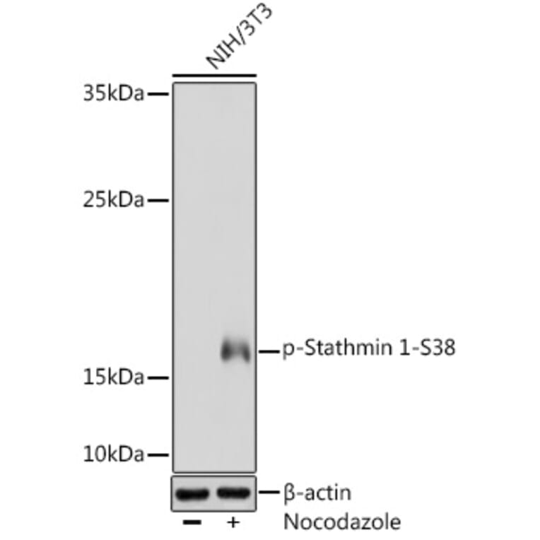 Western Blot - Anti-Stathmin 1 (phospho Ser38) Antibody (A16524) - Antibodies.com