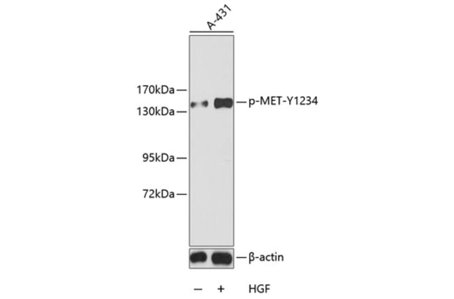 Western Blot - Anti-MET (phospho Y1234) Antibody (AP0222) - Antibodies.com