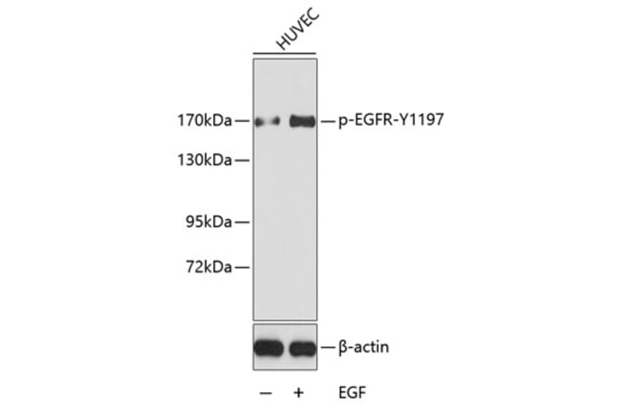 Western Blot - Anti-EGFR (phospho Tyr1197) Antibody (A16526) - Antibodies.com