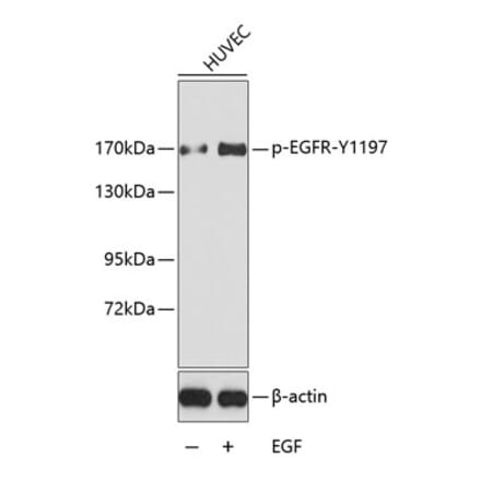 Western Blot - Anti-EGFR (phospho Tyr1197) Antibody (A16526) - Antibodies.com