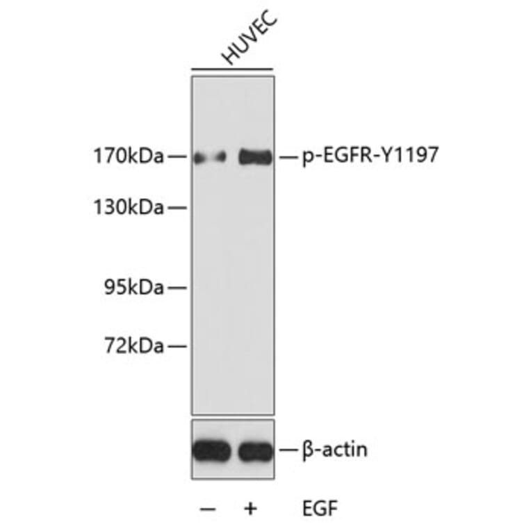 Western Blot - Anti-EGFR (phospho Tyr1197) Antibody (A16526) - Antibodies.com