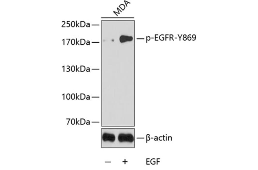 Western Blot - Anti-EGFR (phospho Y869) Antibody (AP0224) - Antibodies.com