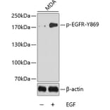 Western Blot - Anti-EGFR (phospho Y869) Antibody (AP0224) - Antibodies.com