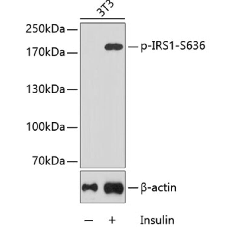 Western Blot - Anti-IRS1 (phospho Ser636) Antibody (A16528) - Antibodies.com