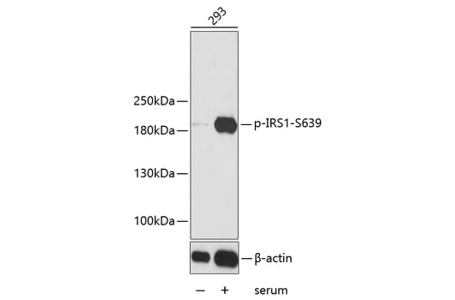 Western Blot - Anti-IRS1 (phospho S639) Antibody (AP0226) - Antibodies.com