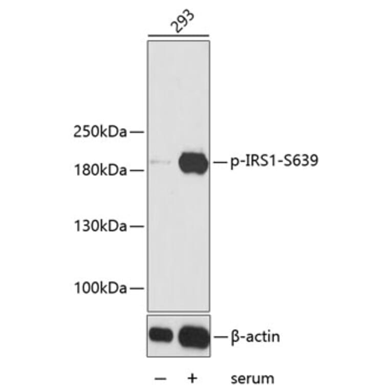 Western Blot - Anti-IRS1 (phospho S639) Antibody (AP0226) - Antibodies.com