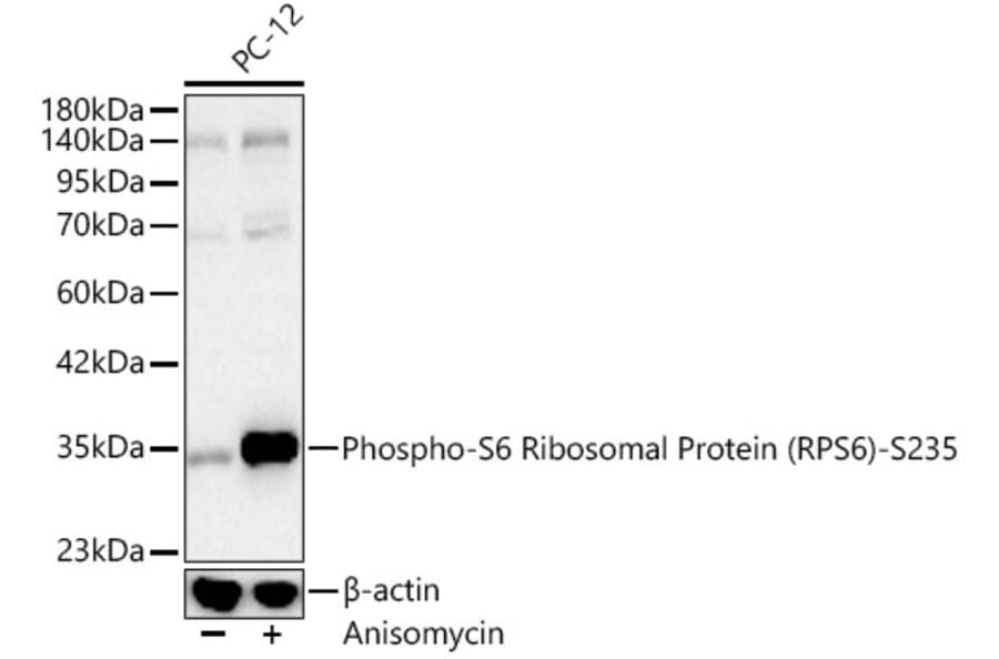 Western Blot - Anti-RPS6 (Phospho S235) Antibody (A16530) - Antibodies.com
