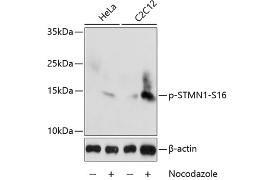 Western Blot - Anti-Stathmin 1 (phospho Ser16) Antibody (A16531) - Antibodies.com