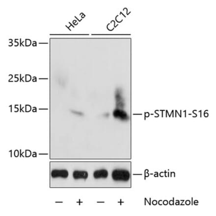 Western Blot - Anti-Stathmin 1 (phospho Ser16) Antibody (A16531) - Antibodies.com