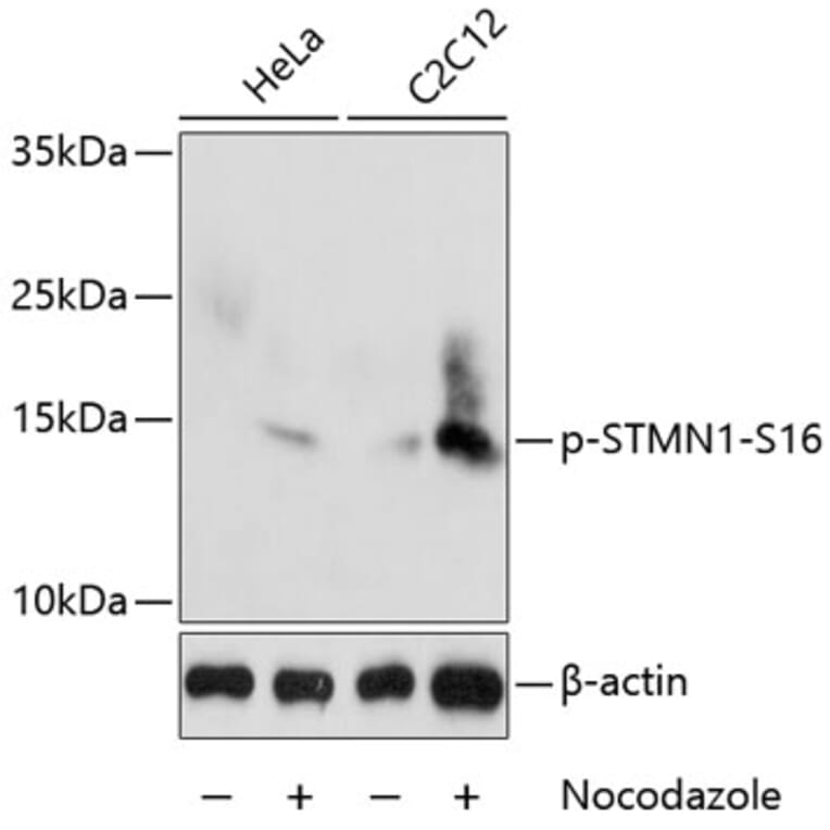 Western Blot - Anti-Stathmin 1 (phospho Ser16) Antibody (A16531) - Antibodies.com