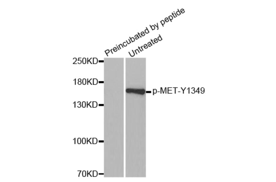 Western Blot - Anti-MET (phospho Y1349) Antibody (AP0230) - Antibodies.com