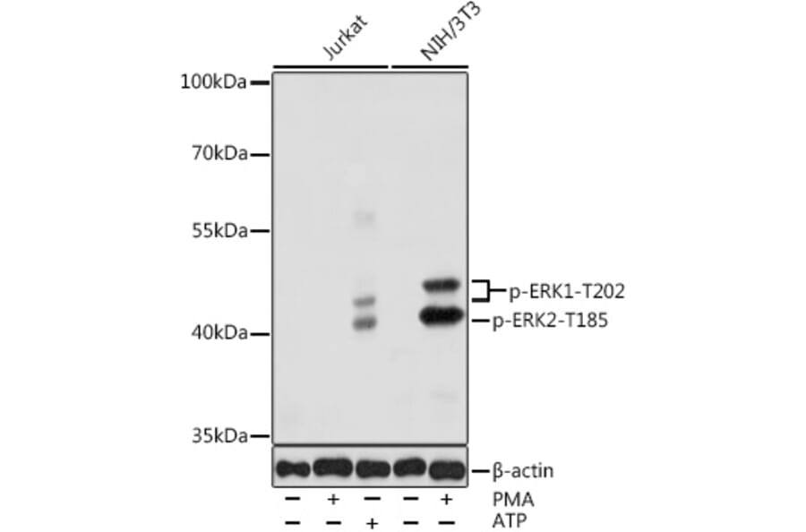 Western Blot - Anti-ERK1 (phospho Thr202) + ERK2 (phospho Thr185) Antibody (A16535) - Antibodies.com