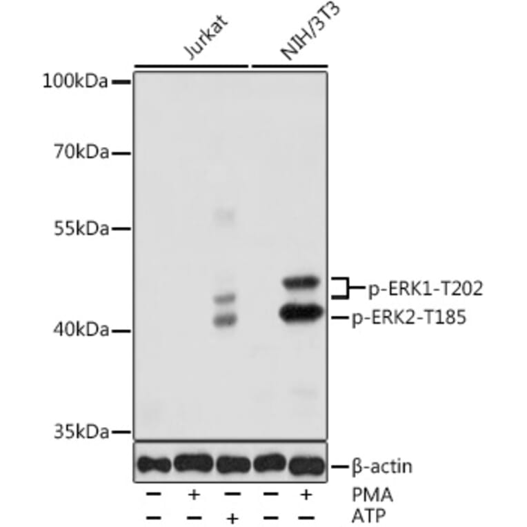 Western Blot - Anti-ERK1 (phospho Thr202) + ERK2 (phospho Thr185) Antibody (A16535) - Antibodies.com
