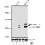 Western Blot - Anti-ERK1 (phospho Thr202) + ERK2 (phospho Thr185) Antibody (A16535) - Antibodies.com