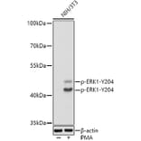 Western Blot - Anti-ERK1 (phospho Tyr204) Antibody (A16536) - Antibodies.com