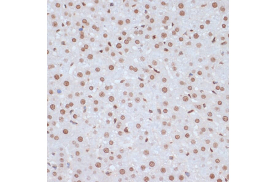 Immunohistochemistry - Anti-ERK1 (phospho Tyr204) Antibody (A16536) - Antibodies.com