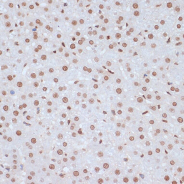Immunohistochemistry - Anti-ERK1 (phospho Tyr204) Antibody (A16536) - Antibodies.com