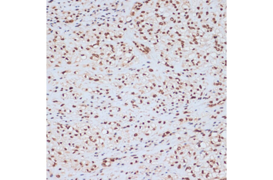 Immunohistochemistry - Anti-ERK1 (phospho Tyr204) Antibody (A16536) - Antibodies.com