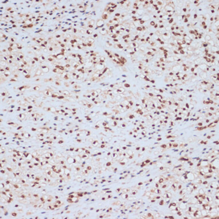 Immunohistochemistry - Anti-ERK1 (phospho Tyr204) Antibody (A16536) - Antibodies.com