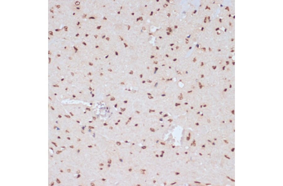 Immunohistochemistry - Anti-ERK1 (phospho Tyr204) Antibody (A16536) - Antibodies.com